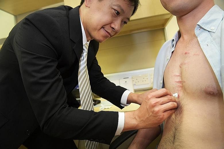 Dr Tey Hong Liang, who heads the National Skin Centre's research department, doing a mock demonstration of applying the micro-needle patch (above, left) on a patient with keloids.