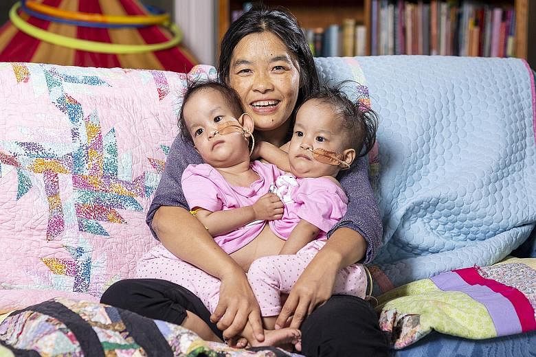 Ms Bhumchu Zangmo holding her conjoined twins Nima and Dawa before their surgery. The 15-month-old Bhutanese twins were separated in a six-hour operation at the Royal Children's Hospital Melbourne yesterday.