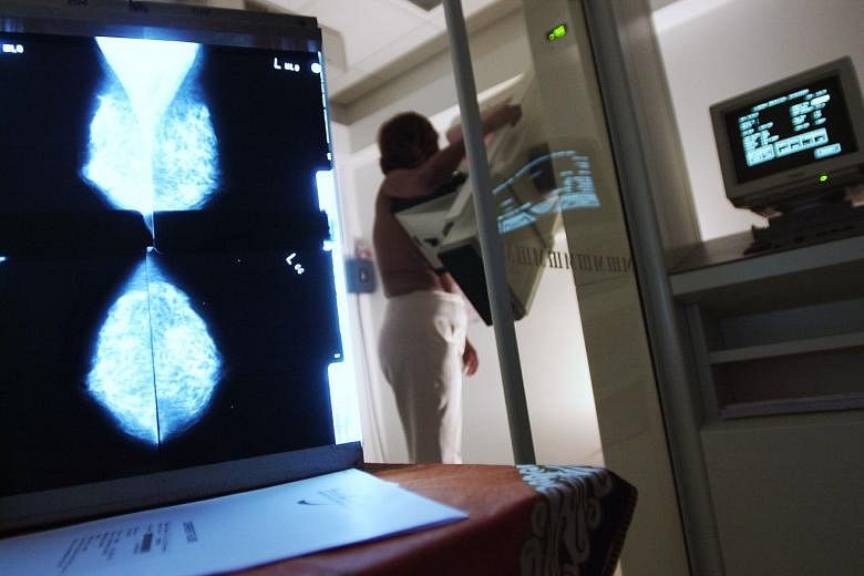 A posed photo of a patient undergoing a mammogram. Scientists have devised a new online calculator which they hope can combine information on family history and genetics with factors such as weight to predict a woman’s risk of breast cancer. 
