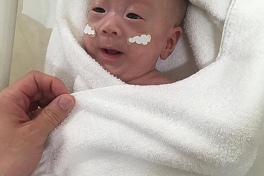 This tiny baby was delivered at 24 weeks, last August, reportedly after he stopped growing in his mother's womb. He was so small that he could fit in an adult's cupped hands, said Keio University Hospital in Tokyo where the infant was born. The baby,