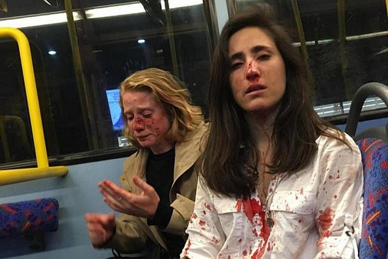 Ms Melania Geymonat (right) and her girlfriend, Chris, after they were attacked on the top deck of a bus in North London last month.