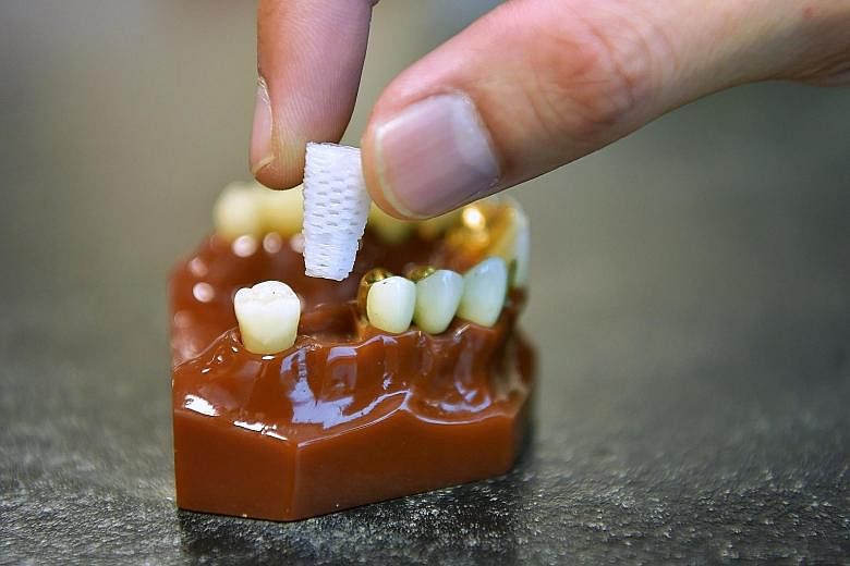 The 3D-printed dental plug aids bone growth in the jaw, reducing chances of bone shrinkage after an extraction. (From left) Chief executive of Singapore Clinical Research Institute Teoh Yee Leong, Osteopore chief technology officer Lim Jing, co-inves