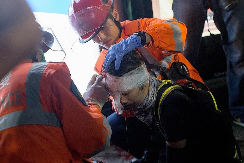 The injured woman being treated by medics in Tsim Sha Tsui in Hong Kong on Sunday. The police, who have been accused of causing the injury by firing a bean-bag round, said it was not clear what really happened. PHOTO:EPA-EFE A protester wearing an ey