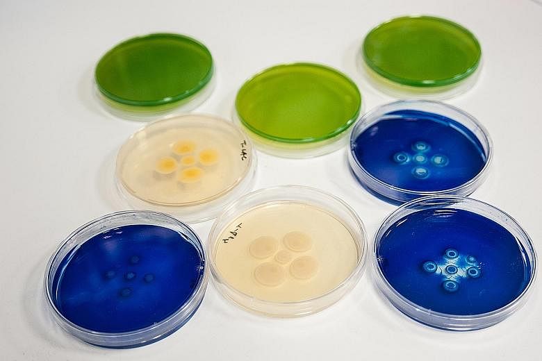 Superbugs cultivated in a laboratory. The global spread of superbug infections is frightening, and the emergence of new resistance mechanisms and the spread of resistance to common infections are now a daily reality for us all, says the writer.