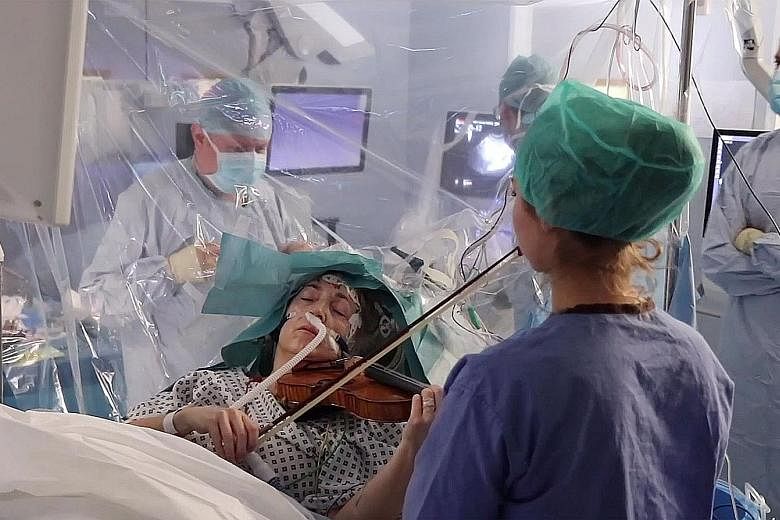 An image from video footage showing violinist Dagmar Turner playing the violin as doctors monitored her movements on screens during her brain surgery on Jan 31. She helped surgeons avoid damage to her brain during the operation to remove a tumour by 