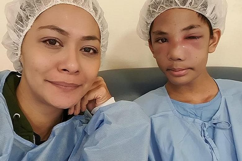 Miss Noridayu Zainuddin and son Imann, who was injured after getting hit in the face on Feb 18 by one of his religious teachers at the Maahad Tahfiz Wattarbiyah school in Selangor, Malaysia. The teen is getting better at KK Women's and Children's Hos
