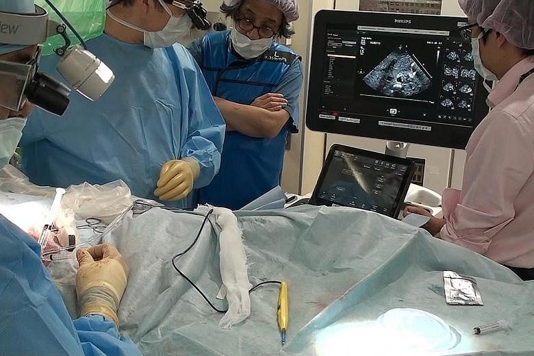A team at work during a liver cell transplant in Tokyo. Doctors successfully transplanted liver cells into a baby with urea cycle disorder, raising hopes for new treatment options for infants.