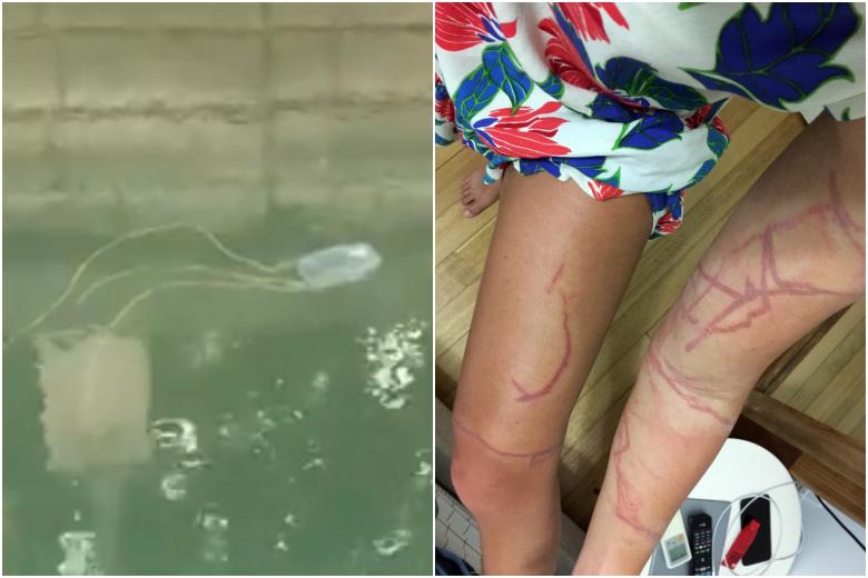 At least 2 people in Singapore stung by deadly box jellyfish The