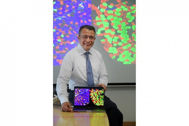 Associate Professor Alfredo Franco-Obregon of the National University of Singapore's Institute for Health Innovation and Technology showing an image with the different muscle fibre types. The green fibres are those where TRPC1, which confers sensitiv