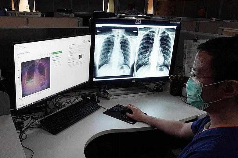 There are benefits to artificial intelligence technologies like this one which can predict the severity of pneumonia in a patient based on an X-ray image. But AI can also run amok with unintended outcomes.