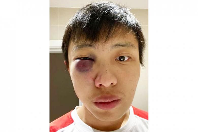 Mr Jonathan Mok was attacked in London last February, and needed surgery for his facial injuries.
