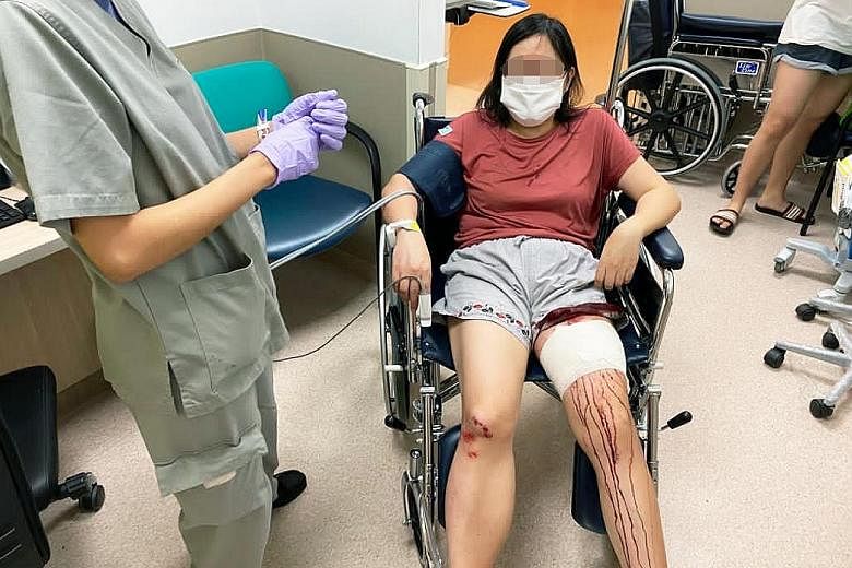 A wild boar that charged at Madam Yu in Pasir Ris left her with a 10cm-long gash on her leg and facial injuries. PHOTO: MADAM YU