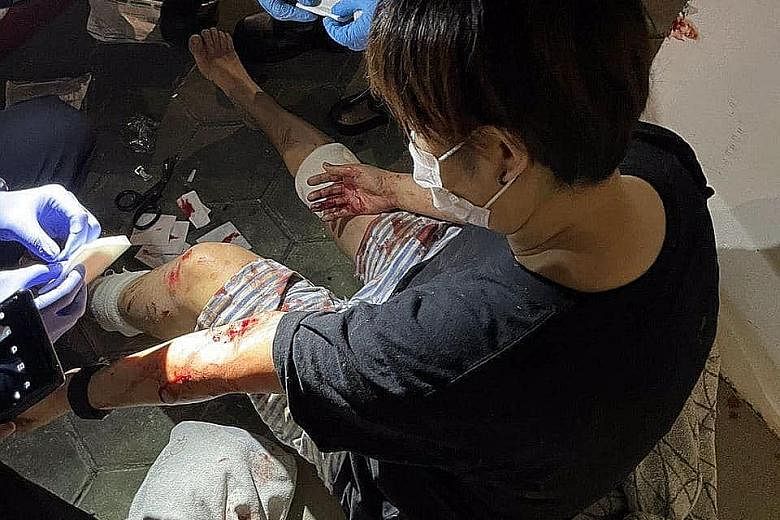 Paramedics attending to a woman who was bitten by a wild boar in Punggol Walk last Saturday night. Another person was attacked shortly after, it is believed, by the same animal. PHOTO: LIANHE ZAOBAO READER
