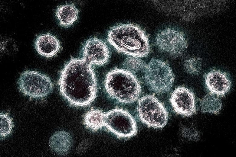 The Sars-CoV-2 virus that causes Covid-19. Researchers from the Singapore-MIT Alliance for Research and Technology say the Radica method can provide the specific viral load of a sample.