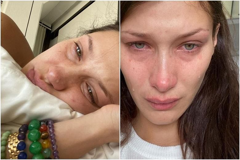 Model Bella Hadid Opens Up About Her Mental Health Struggles The Straits Times