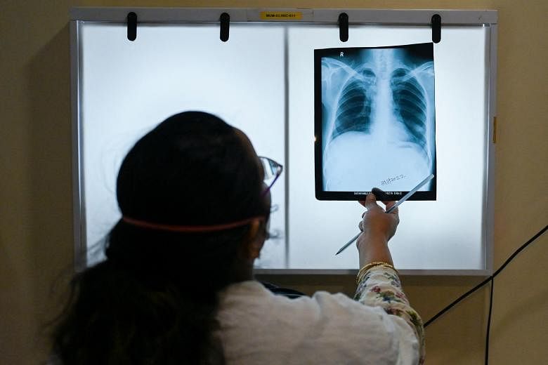The fight to stop Covid-19 has hurt India’s efforts to fight tuberculosis