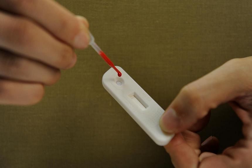 HIV self-test swab kits to go on sale from Aug 1, as new cases fall to new low in 2021