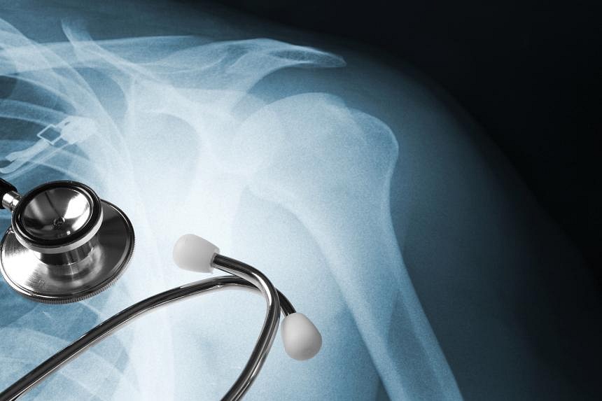 Chances of a shoulder dislocation are higher for those active in certain sports and activities