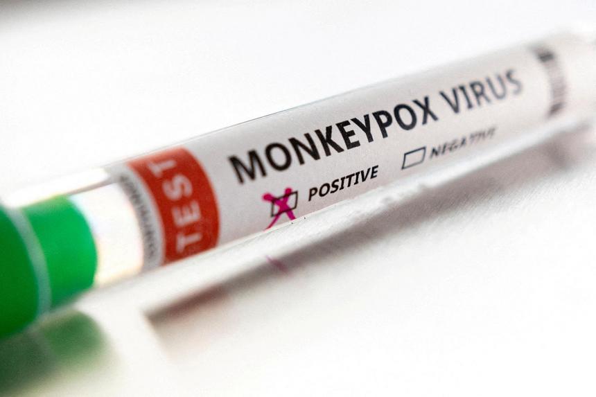 First case of monkeypox in Japan detected in Tokyo: Media | The Straits ...