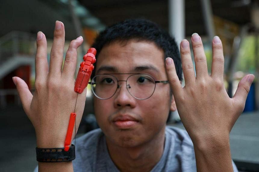 Engineering student in Singapore gets 3D-printed finger after bike