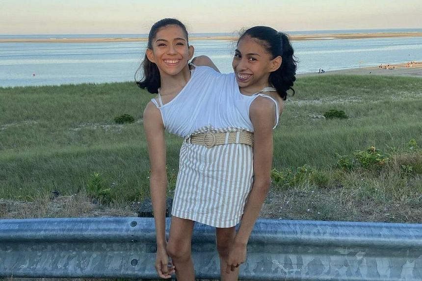22yearold US conjoined twin sisters drive, date and focus on living