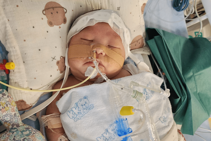 Month-old baby with heart defect had 2 strokes, 2 ops; parents raising ...