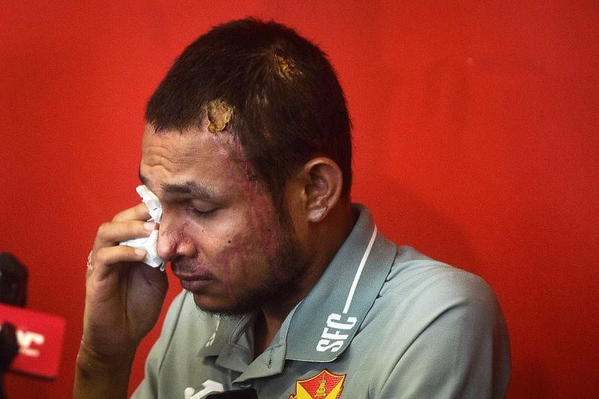 马来西亚足球运动员遭硫酸袭击受重伤 差点退役 誓言重返赛场