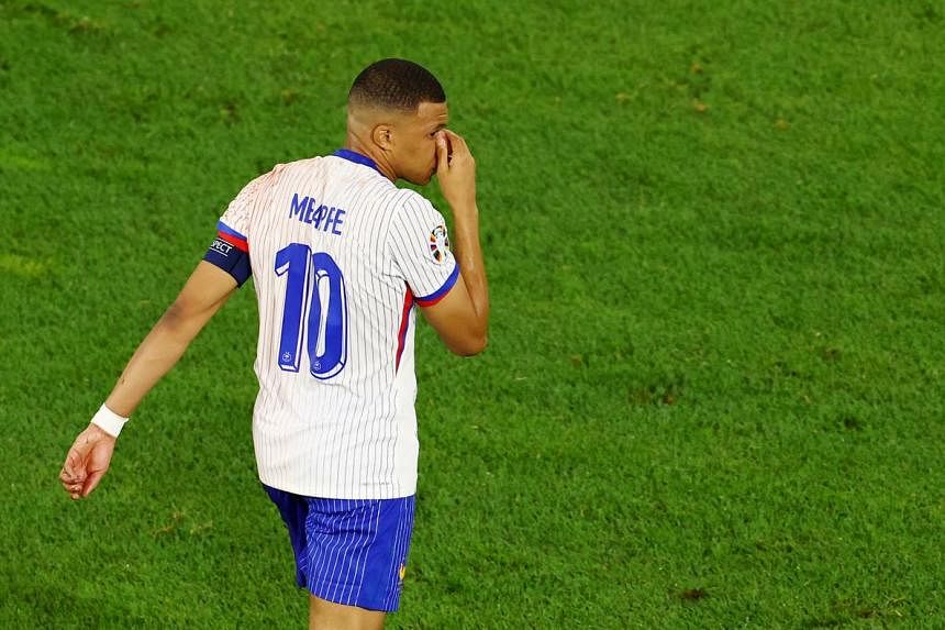 Mbappe breaks nose, will wear a mask, says French Federation