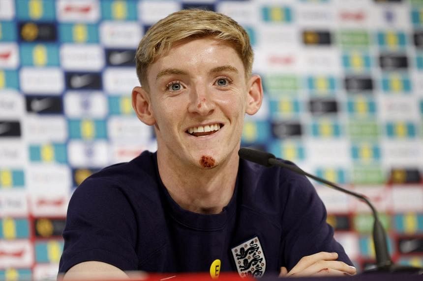 England's Gordon promises to mark bike crash with goal celebration