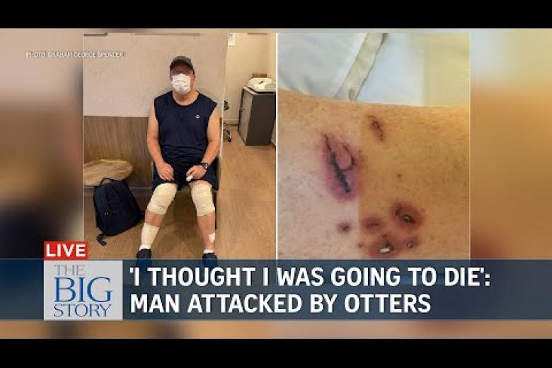 The Big Story: Man who was attacked by otters at Botanic Gardens