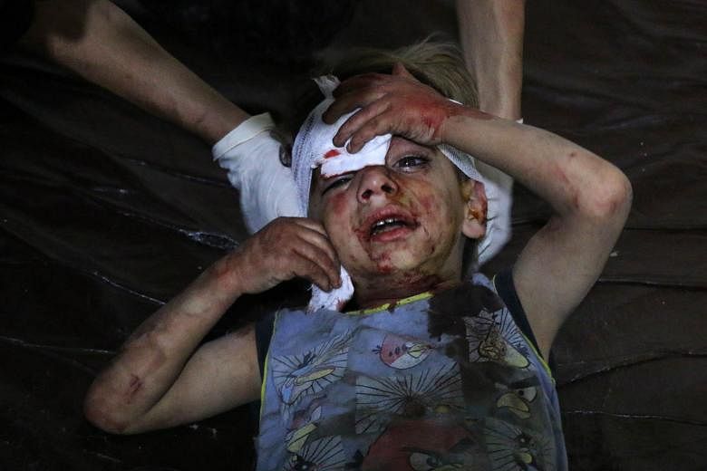 A child receiving treatment at a field hospital following government air strikes on a popular market in a rebel stronghold east of Damascus on Tuesday.
