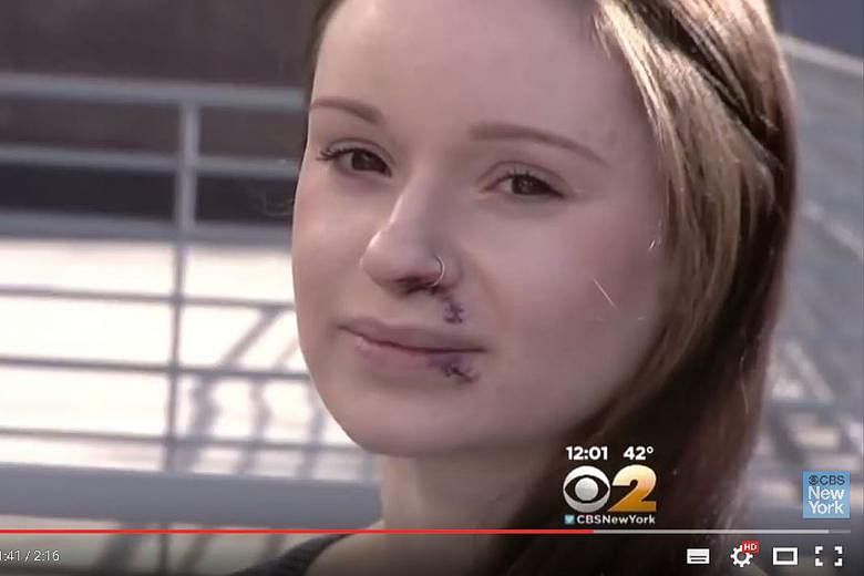 Ms Amanda Morris, one of the victims, is seen here in a screen grab from a YouTube video of a CBS News interview. She was attacked by a stranger this month on her way to work at Whole Foods in Chelsea, New York.