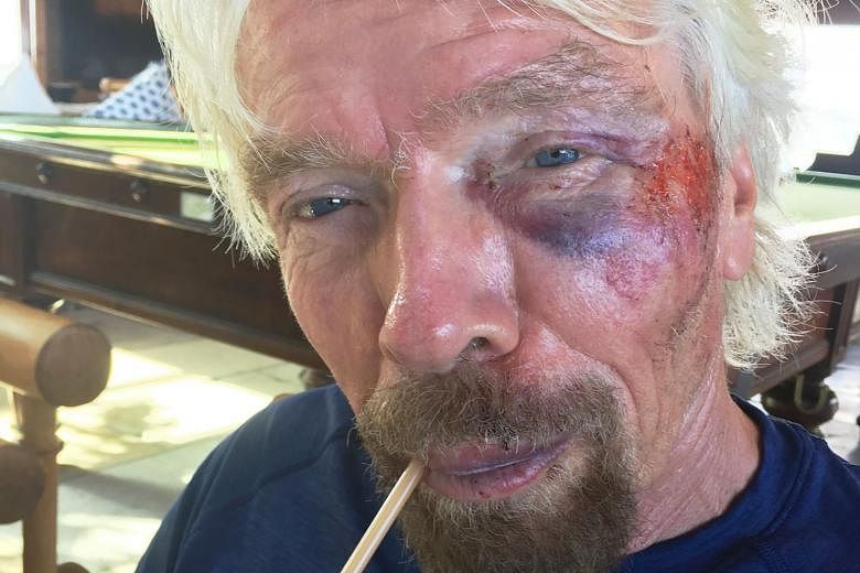 Mr Branson said he thought he was going to die in the biking accident in the British Virgin Islands last week. He suffered injuries to his cheek and torn ligaments.