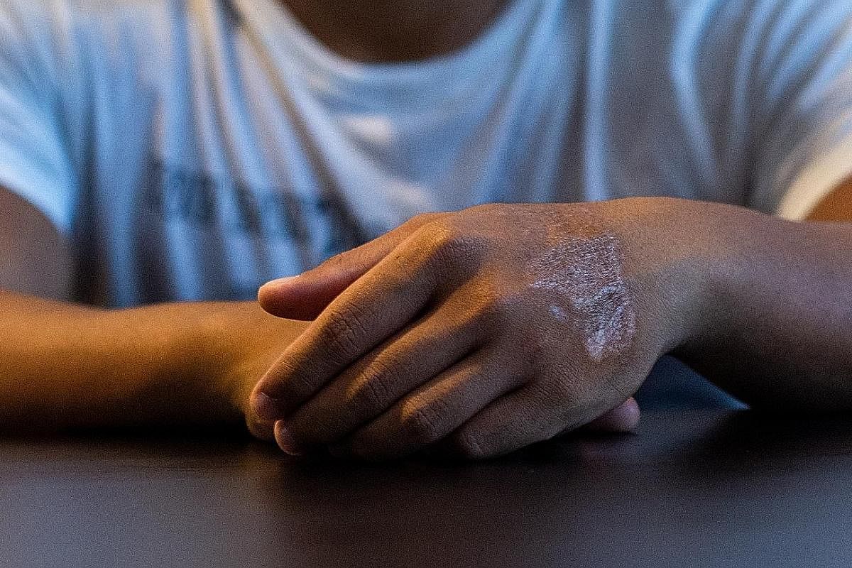 Azerael* (above) became homeless at 18 and spent the next six years with friends and extended family members. To keep his place in a nursing course, he scrubbed off the tattoo on his hand with salt and a brush, which left him with a huge scar.
